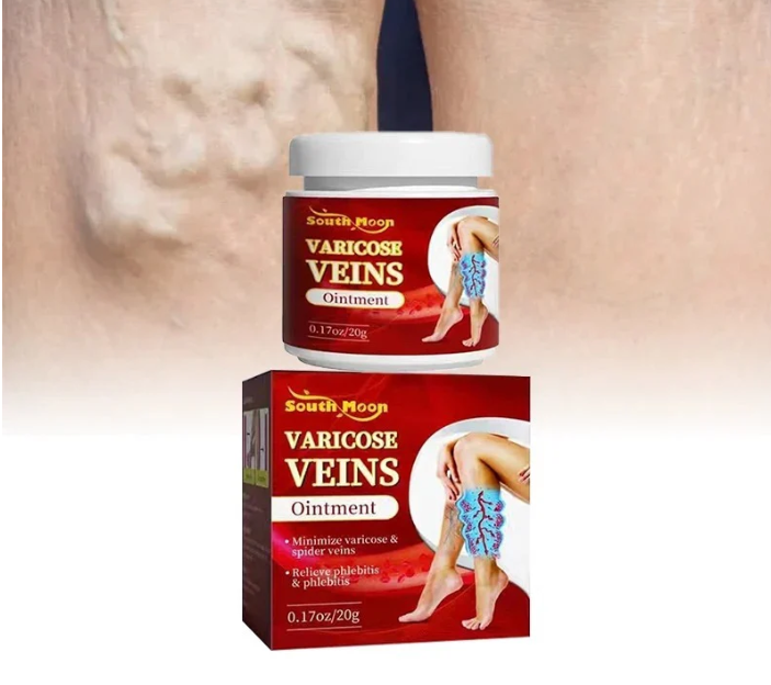 Varicose veins crema para varices